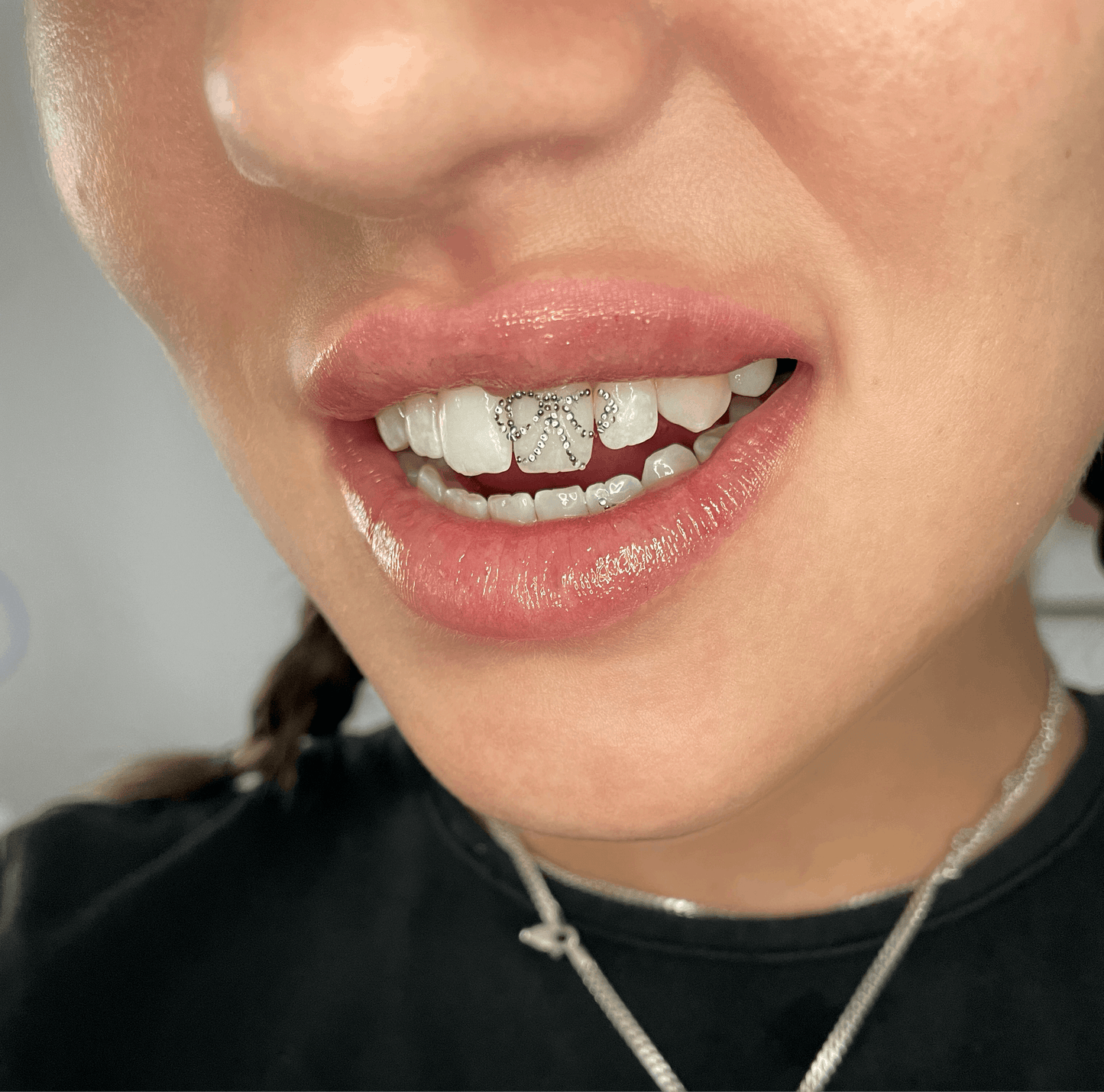 Diamond Caviar - Micro Tooth Gems