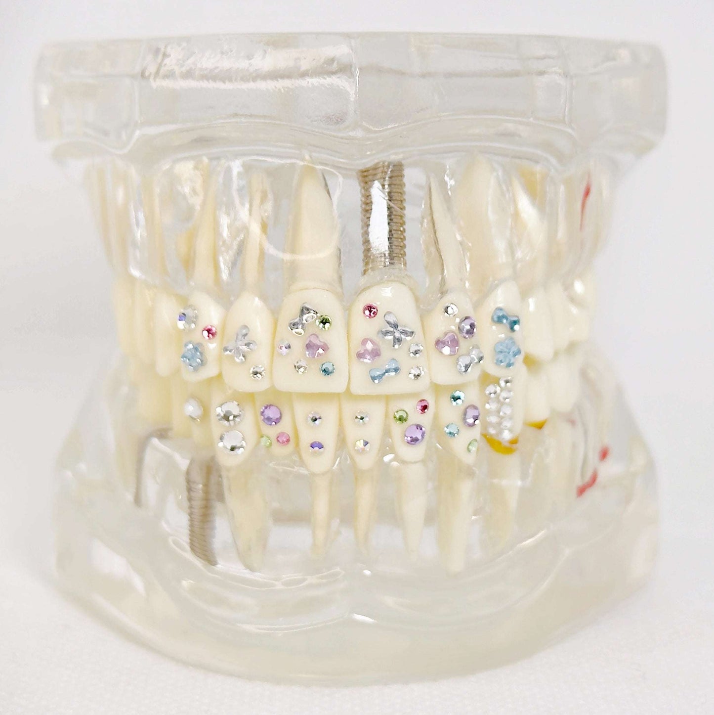 Miss Binge - Tooth Gems