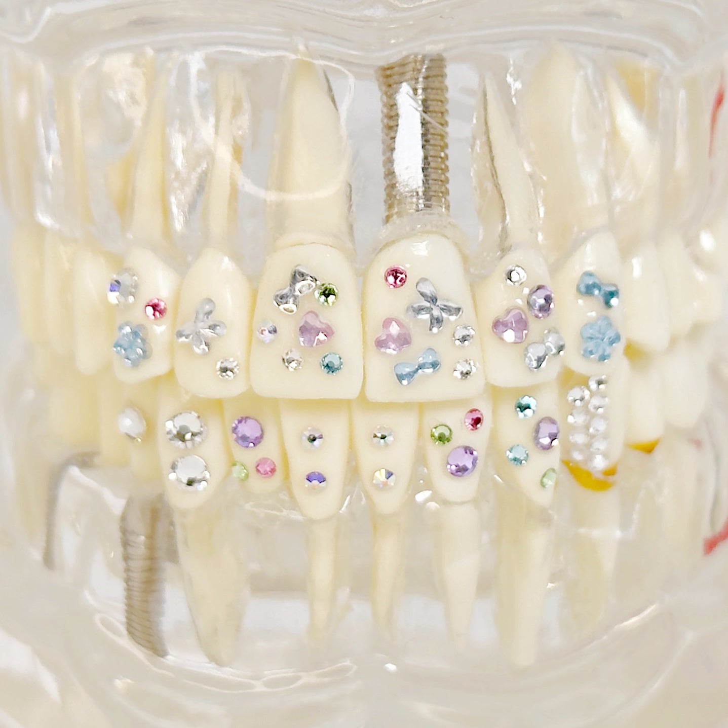 Miss Binge - Tooth Gems