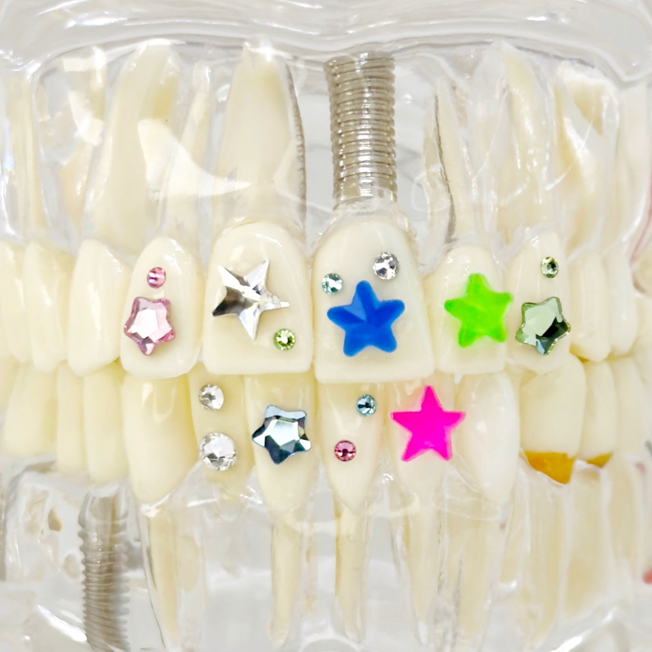 tooth gems, teeth crystals, dental adhesive, tooth gem glue, diy tooth crystal, tooth sparkle, skyce tooth gems, tooth gem kit, teeth sparkle, tooth diamond, DIY tooth gem kit, skyce No alt text