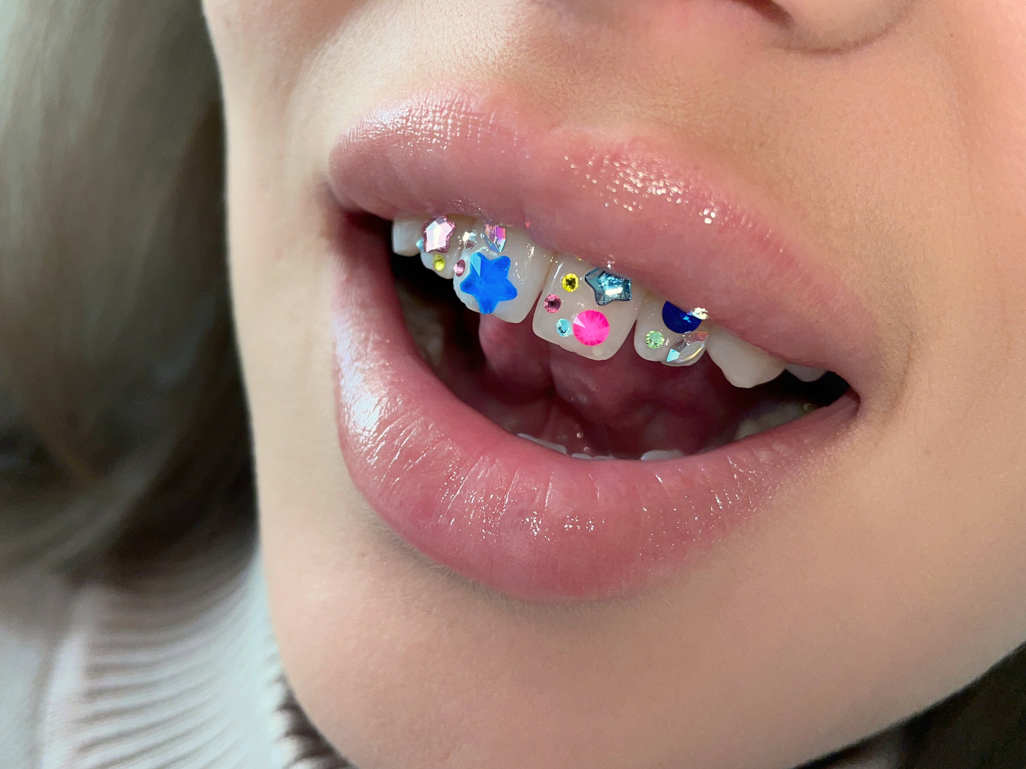 How to Remove Tooth Gems? – SIA ICY